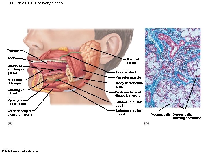 Figure 23. 9 The salivary glands. Tongue Teeth Ducts of sublingual gland Frenulum of