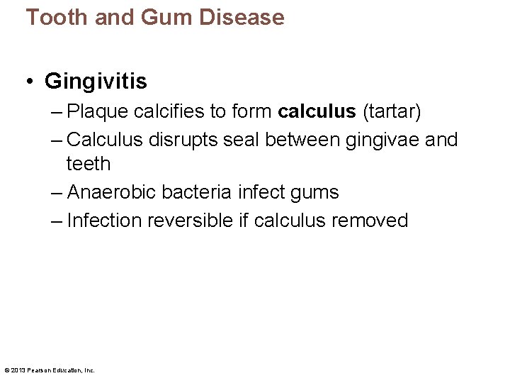Tooth and Gum Disease • Gingivitis – Plaque calcifies to form calculus (tartar) –