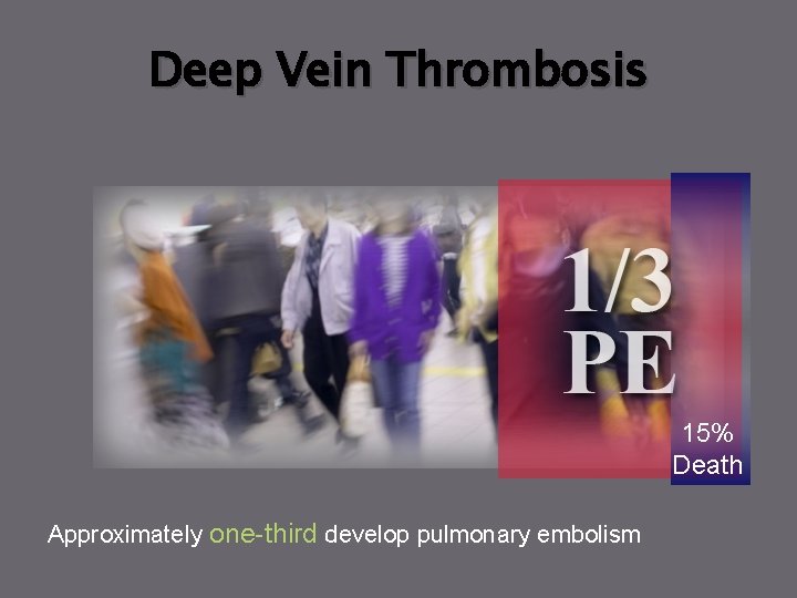 Deep Vein Thrombosis 15% Death Approximately one-third develop pulmonary embolism 