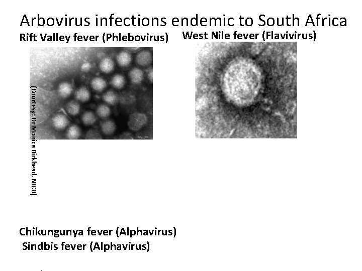 Arbovirus infections endemic to South Africa Rift Valley fever (Phlebovirus) (Courtesy: Dr Monica Birkhead,
