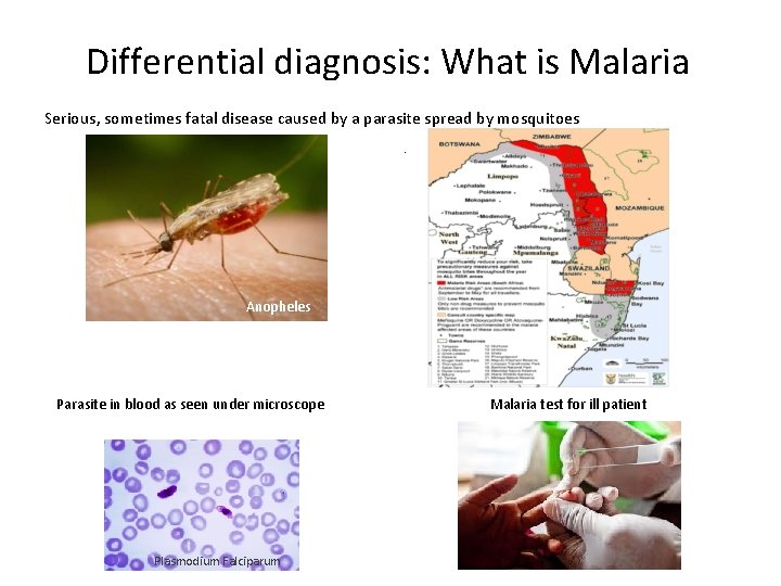 Differential diagnosis: What is Malaria Serious, sometimes fatal disease caused by a parasite spread