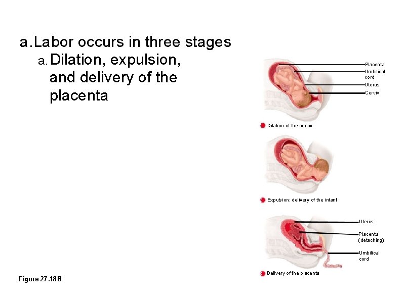 a. Labor occurs in three stages a. Dilation, expulsion, and delivery of the placenta