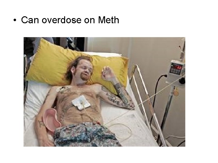  • Can overdose on Meth 