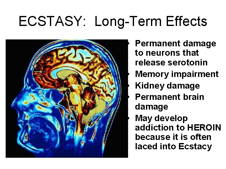 ECSTASY: Long-Term Effects • Permanent damage to neurons that release serotonin • Memory impairment