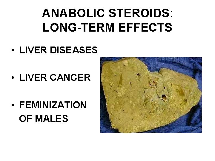 ANABOLIC STEROIDS: LONG-TERM EFFECTS • LIVER DISEASES • LIVER CANCER • FEMINIZATION OF MALES