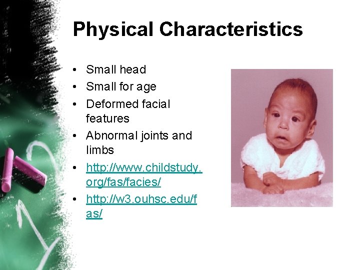 Physical Characteristics • Small head • Small for age • Deformed facial features •