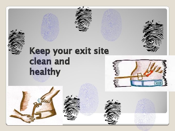 Keep your exit site clean and healthy 