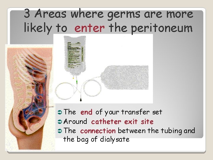 3 Areas where germs are more likely to enter the peritoneum Ü The end