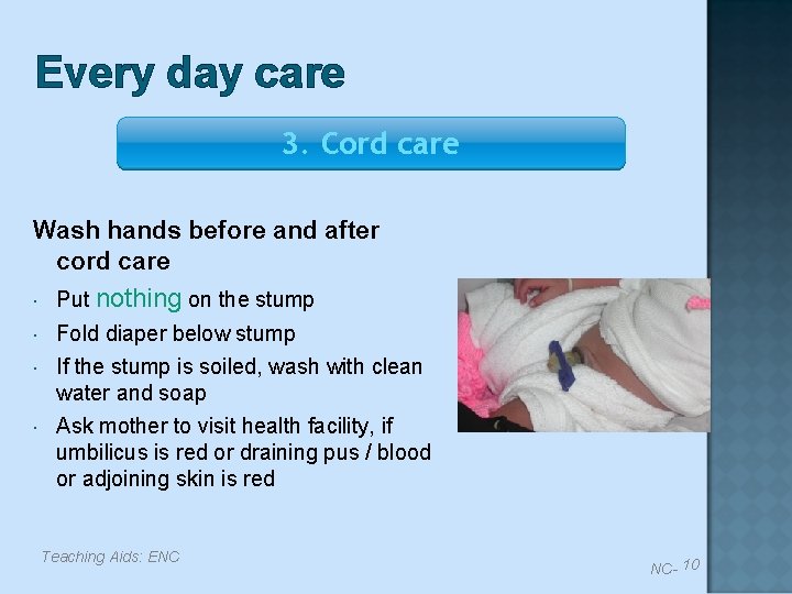 Every day care 3. Cord care Wash hands before and after cord care Put