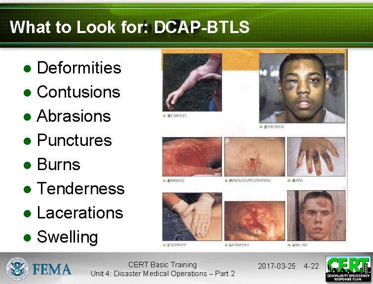 What to Look for: DCAP-BTLS ● Deformities ● Contusions ● Abrasions ● Punctures ●