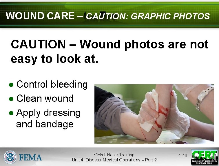 WOUND CARE – CAUTION: GRAPHIC PHOTOS CAUTION – Wound photos are not easy to