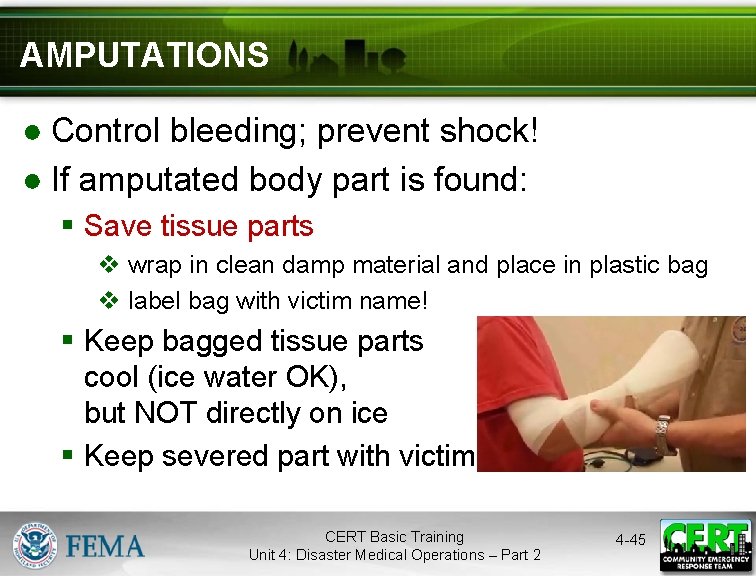 AMPUTATIONS ● Control bleeding; prevent shock! ● If amputated body part is found: §