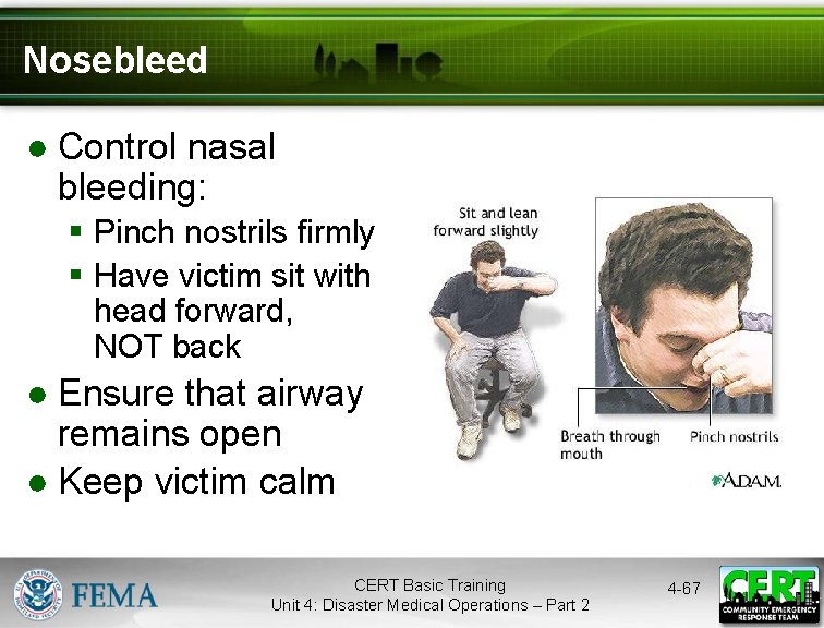 Nosebleed ● Control nasal bleeding: § Pinch nostrils firmly § Have victim sit with