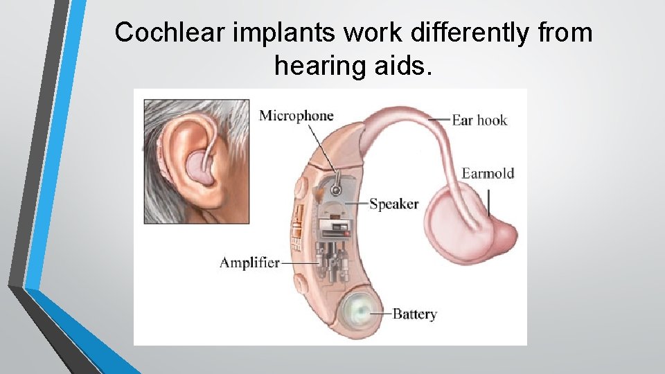 Cochlear implants work differently from hearing aids. 