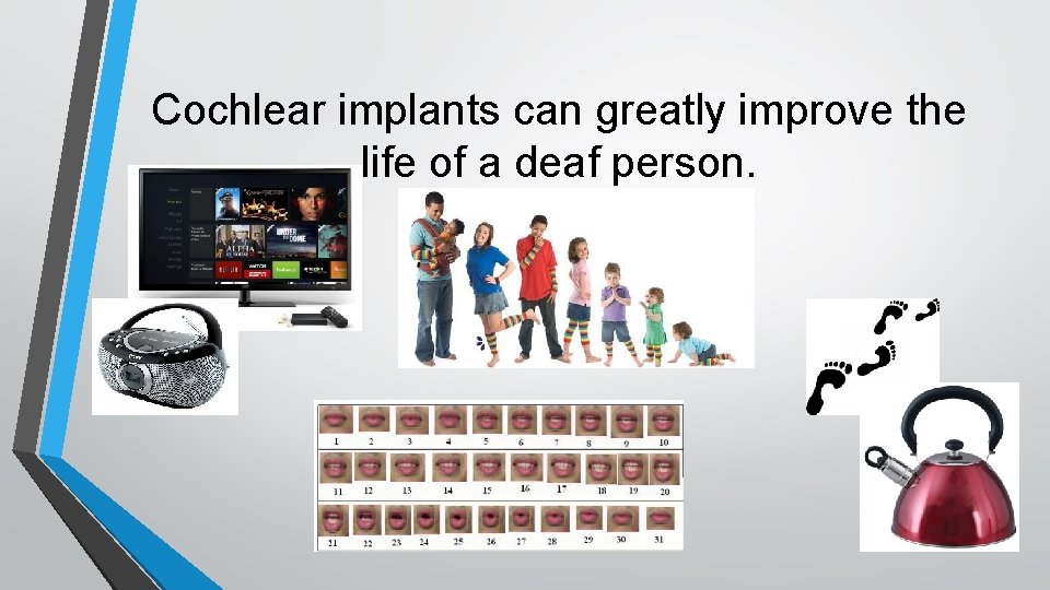 Cochlear implants can greatly improve the life of a deaf person. 
