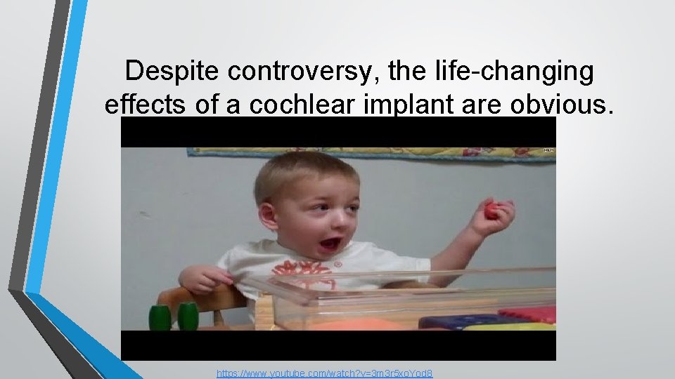 Despite controversy, the life-changing effects of a cochlear implant are obvious. https: //www. youtube.