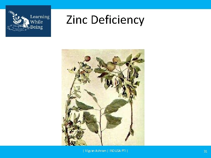 Zinc Deficiency | Vigyan Ashram | INDUSA PTI | 31 