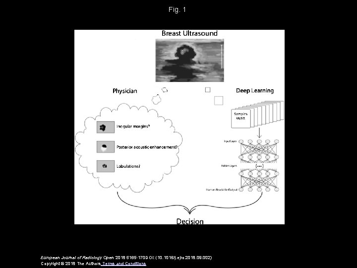 Fig. 1 European Journal of Radiology Open 2018 5165 -170 DOI: (10. 1016/j. ejro.