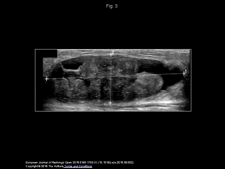Fig. 3 European Journal of Radiology Open 2018 5165 -170 DOI: (10. 1016/j. ejro.