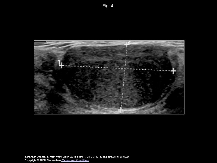 Fig. 4 European Journal of Radiology Open 2018 5165 -170 DOI: (10. 1016/j. ejro.