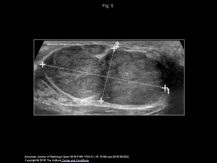 Fig. 5 European Journal of Radiology Open 2018 5165 -170 DOI: (10. 1016/j. ejro.