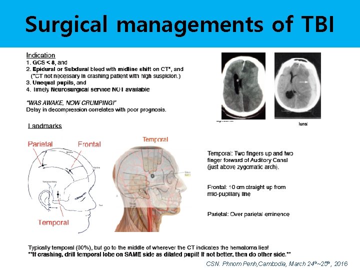 Surgical managements of TBI CSN. Phnom Penh, Cambodia, March 24 th~25 th, 2016 