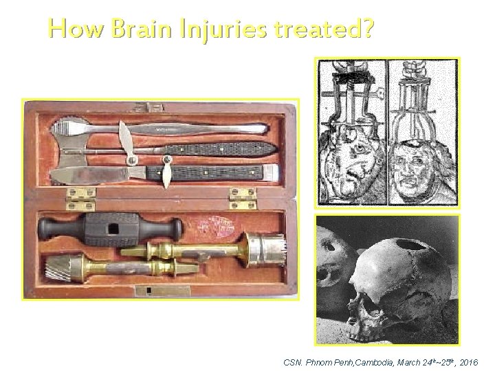 How Brain Injuries treated? CSN. Phnom Penh, Cambodia, March 24 th~25 th, 2016 