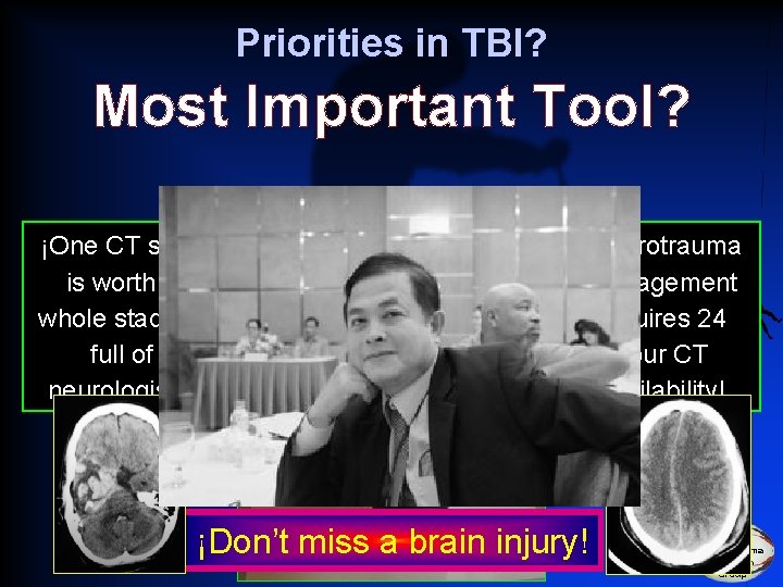Priorities in TBI? Most Important Tool? ¡One CT scan is worth a whole stadium