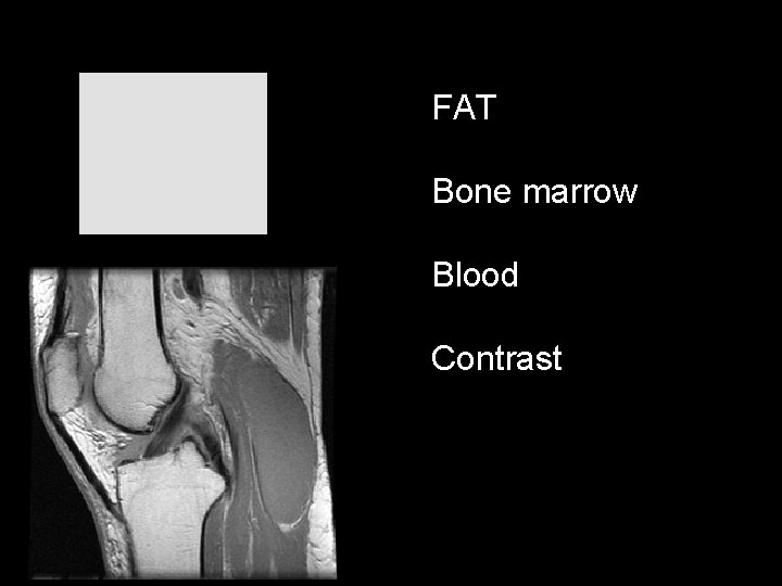 FAT Bone marrow Blood Contrast 