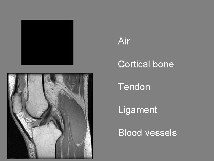 Air Cortical bone Tendon Ligament Blood vessels 