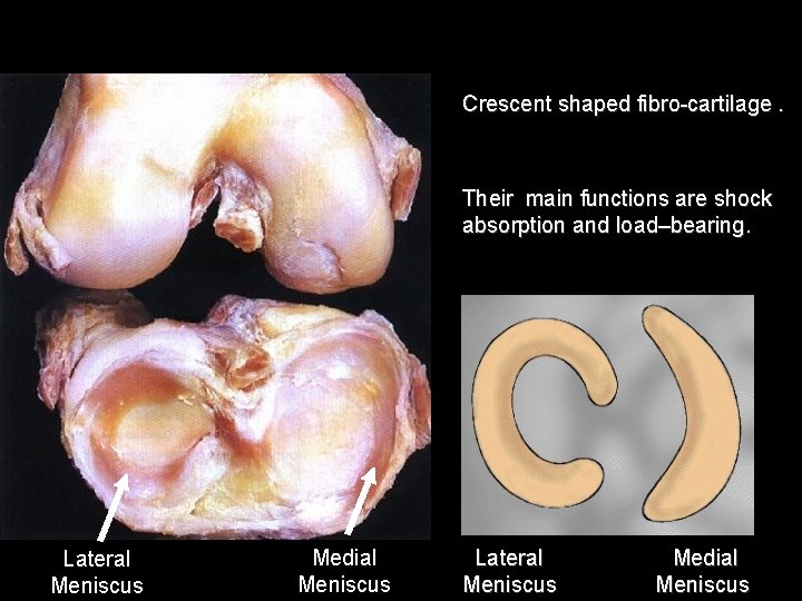 Crescent shaped fibro-cartilage. Their main functions are shock absorption and load–bearing. Lateral Meniscus Medial