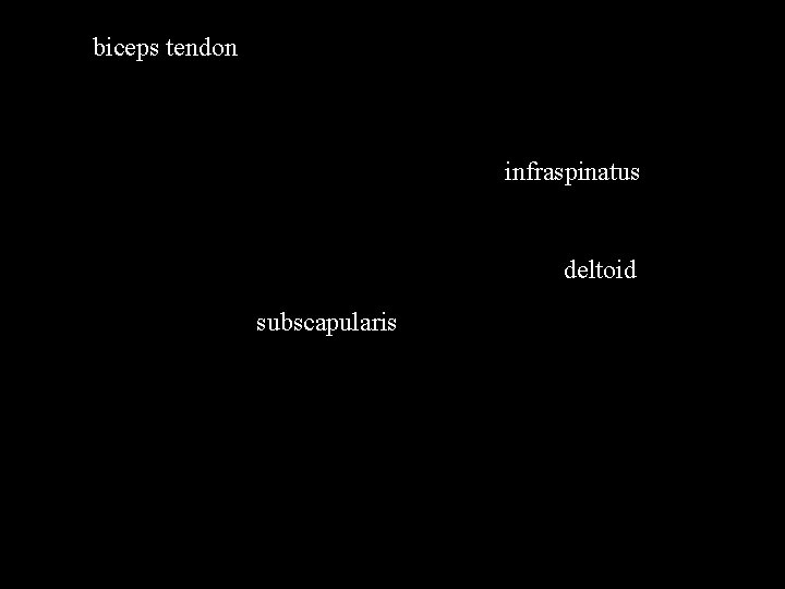 biceps tendon infraspinatus deltoid subscapularis 