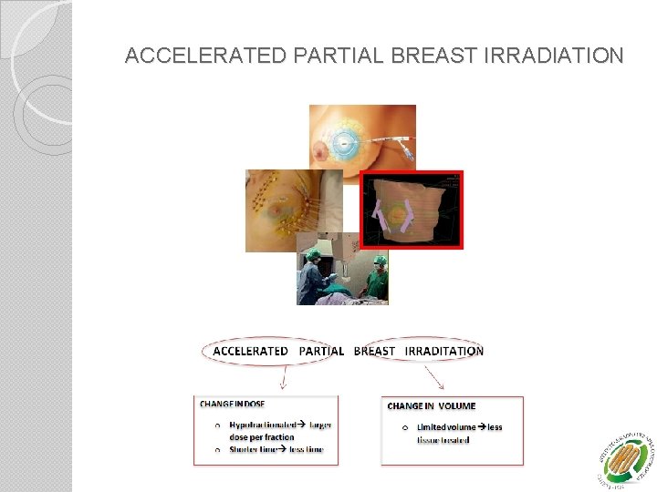 ACCELERATED PARTIAL BREAST IRRADIATION 