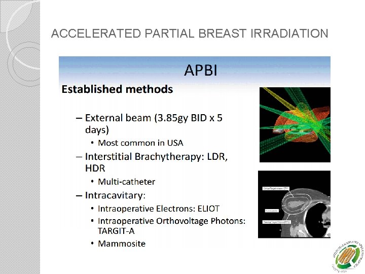 ACCELERATED PARTIAL BREAST IRRADIATION 