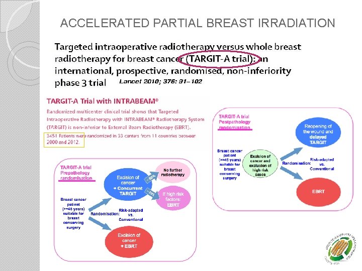 ACCELERATED PARTIAL BREAST IRRADIATION 