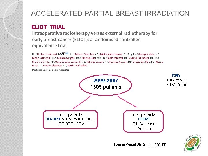 ACCELERATED PARTIAL BREAST IRRADIATION ELIOT TRIAL Italy § 48 -75 yrs § T<2, 5