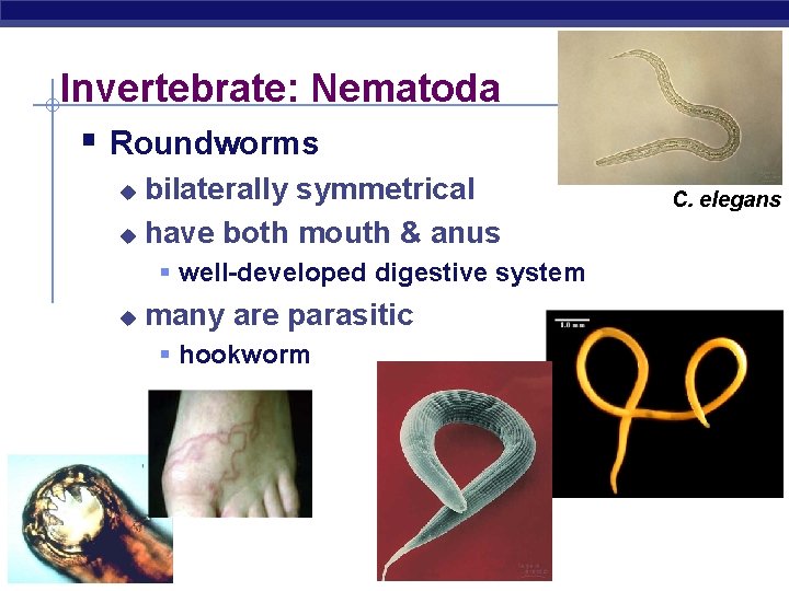 Invertebrate: Nematoda § Roundworms bilaterally symmetrical u have both mouth & anus u §