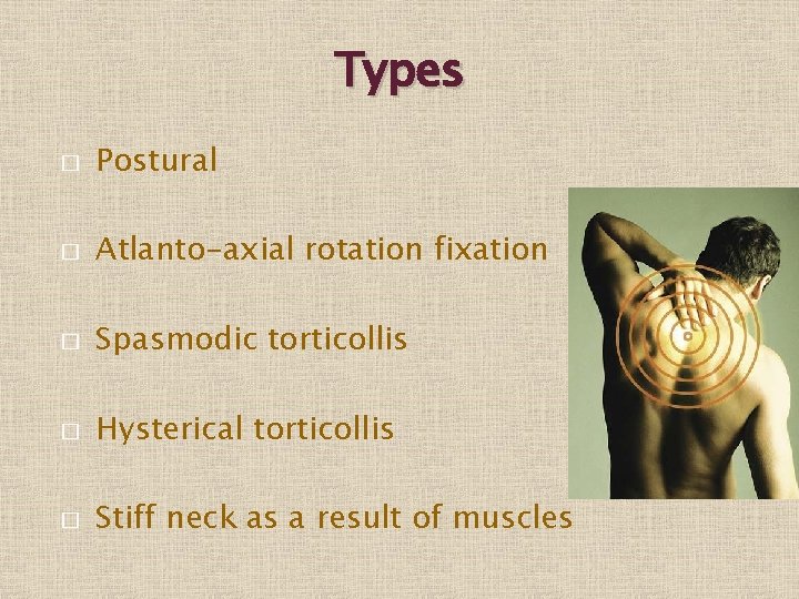 Types � Postural � Atlanto-axial rotation fixation � Spasmodic torticollis � Hysterical torticollis �