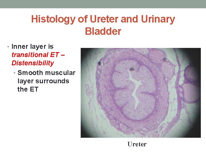 Histology of Ureter and Urinary Bladder • Inner layer is transitional ET – Distensibility Histology of Ureter and Urinary Bladder • Inner layer is transitional ET – Distensibility