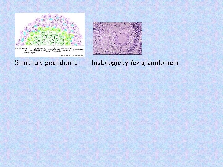 Struktury granulomu histologický řez granulomem 