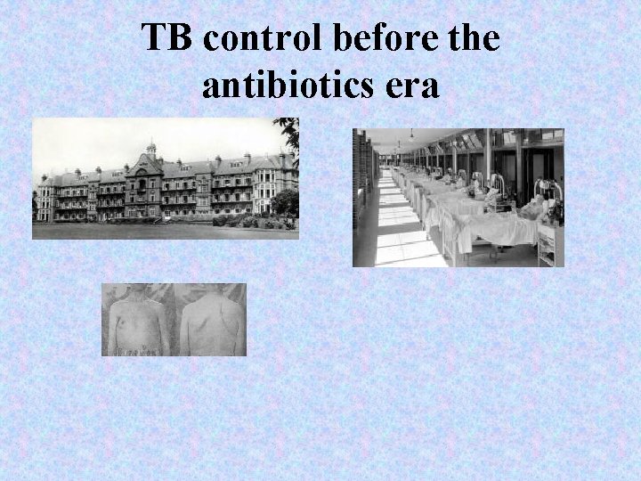 TB control before the antibiotics era 