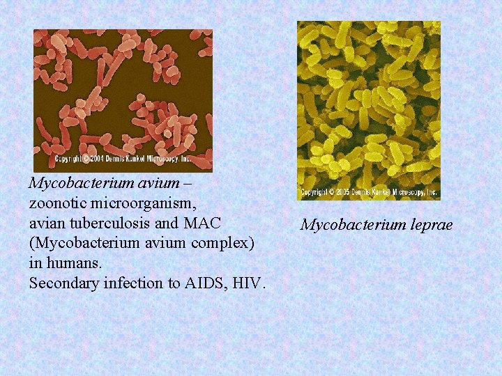 Mycobacterium avium – zoonotic microorganism, avian tuberculosis and MAC (Mycobacterium avium complex) in humans.