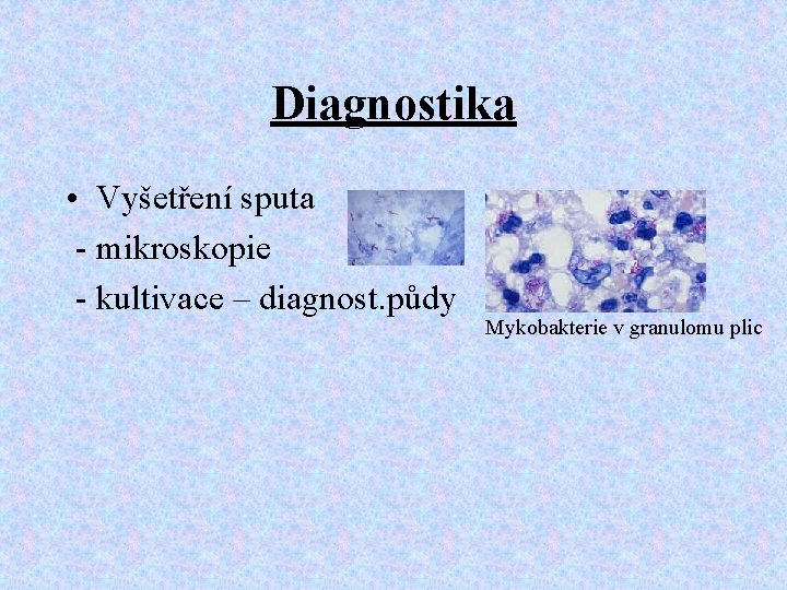 Diagnostika • Vyšetření sputa - mikroskopie - kultivace – diagnost. půdy Mykobakterie v granulomu