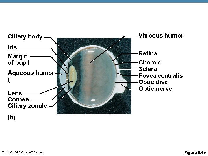 Ciliary body Iris Margin of pupil Aqueous humor ( Lens Cornea Ciliary zonule Vitreous
