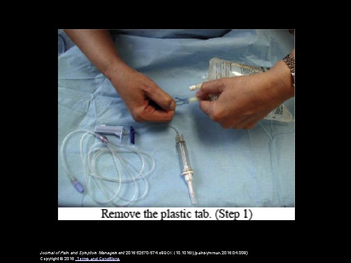 Journal of Pain and Symptom Management 2016 52570 -574. e 9 DOI: (10. 1016/j.