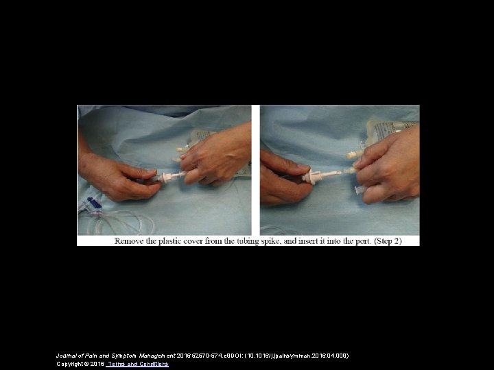 Journal of Pain and Symptom Management 2016 52570 -574. e 9 DOI: (10. 1016/j.