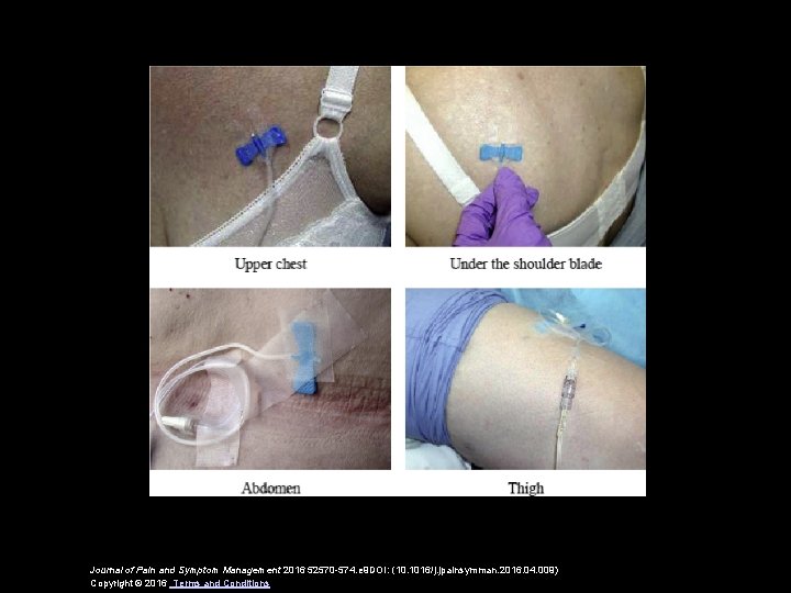 Journal of Pain and Symptom Management 2016 52570 -574. e 9 DOI: (10. 1016/j.