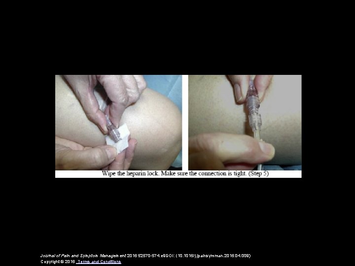 Journal of Pain and Symptom Management 2016 52570 -574. e 9 DOI: (10. 1016/j.
