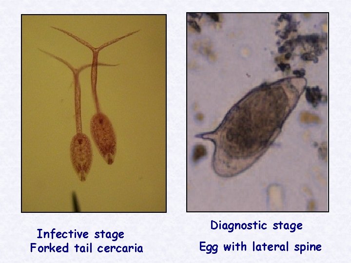 Infective stage Forked tail cercaria Diagnostic stage Egg with lateral spine 