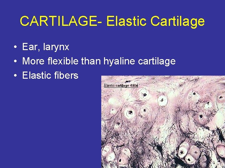 CARTILAGE- Elastic Cartilage • Ear, larynx • More flexible than hyaline cartilage • Elastic